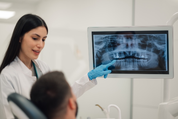 Dental Checkups: What Is The Dentist Looking For?